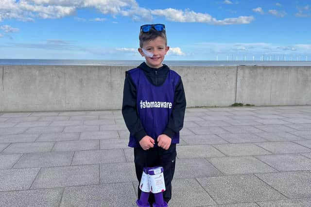 Jack Dale completed a 50-mile triathlon in March to raise money for Colostomy UK, a charity that supports people living with a stoma.