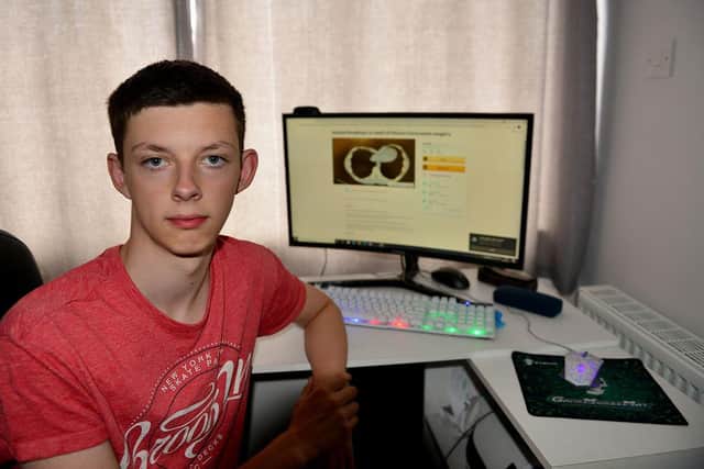 Joshua Readman next to a scan which shows the effect his condition was having on his heart before his operation.