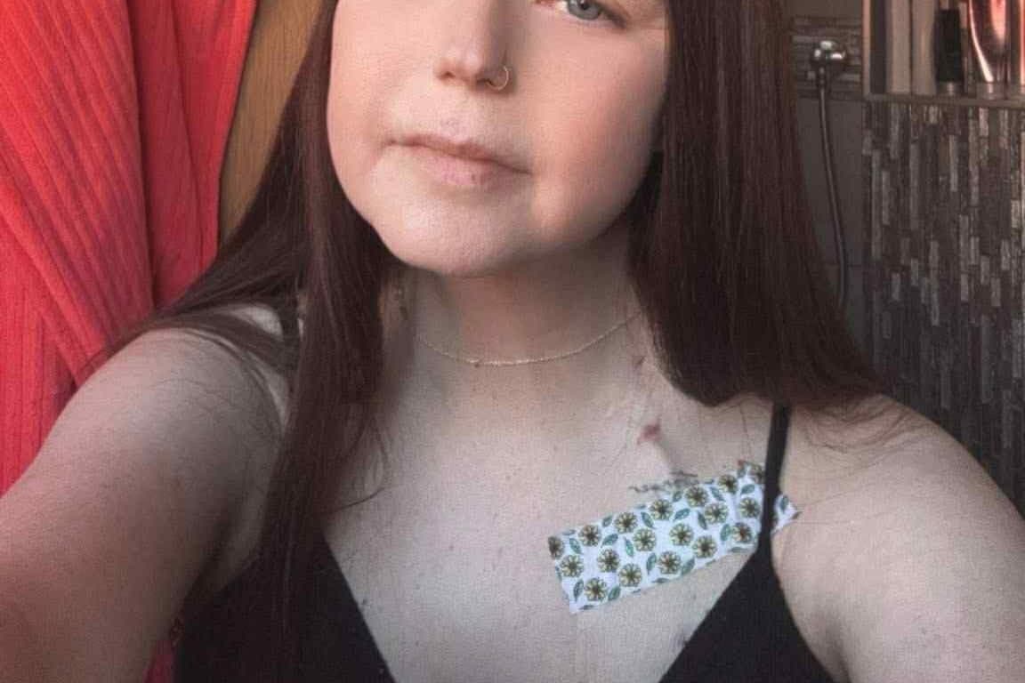 Eine mutige 25-jährige Frau aus Hartlepool, die auf eine ...