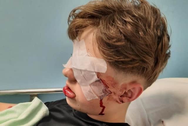 Aleks in hospital after his accident.