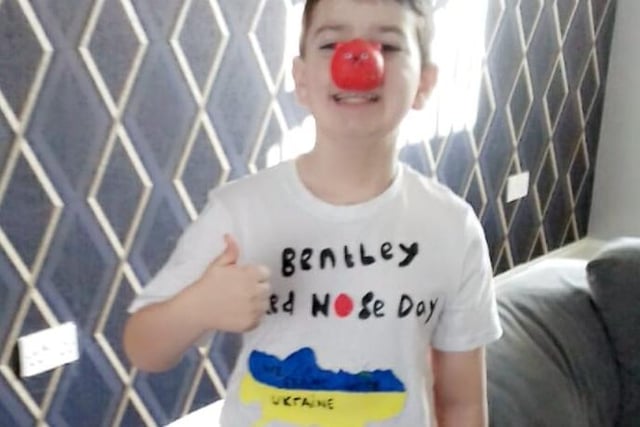 Bentley showing his support for Red Nose Day and also those affected by the conflict in Ukraine with a blue and yellow design.