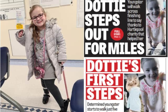 What a transformation. Look at Dottie O'Keefe now - just three years after she underwent an operation.