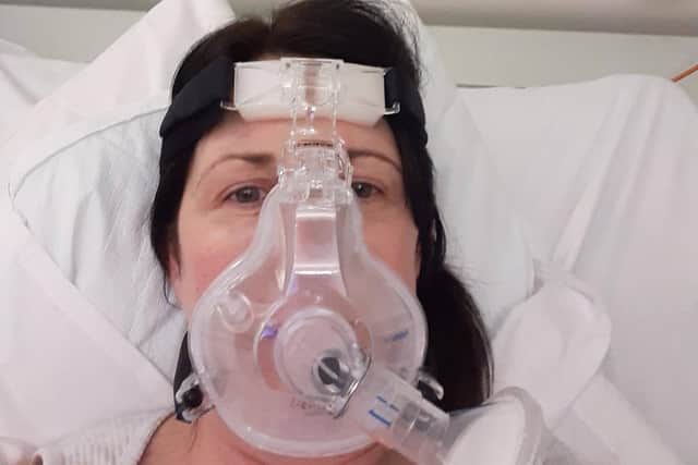 Oxygen was forced into Sue's lungs with a CPAP machine while in hospital with Covid-19.