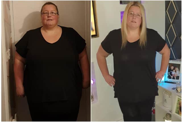 Samantha Usher at her heaviest and after losing the weight following surgery.