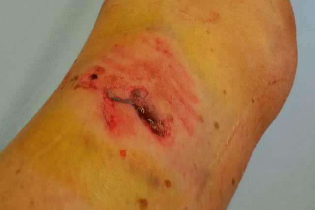 Chloe Taylor's injury after the attack.