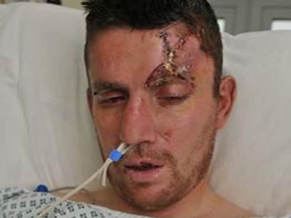 Durham Police photos show the injuries stutained by Richard Stark, who was badly beaten up in a street attack