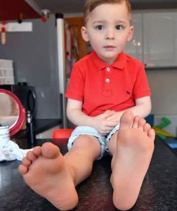 A small mark can be seen on the left sole of Logan Pearce's foot  after he stood on a needle in the garden of his Hartlepool home. Picture by FRANK REID