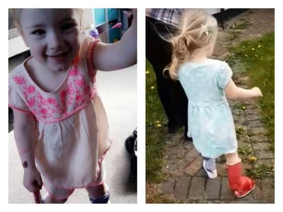 Dottie O'Keefe has taken her first steps, and could soon be able to walk unaided.